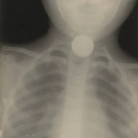 Cover artwork for swallowed a coin